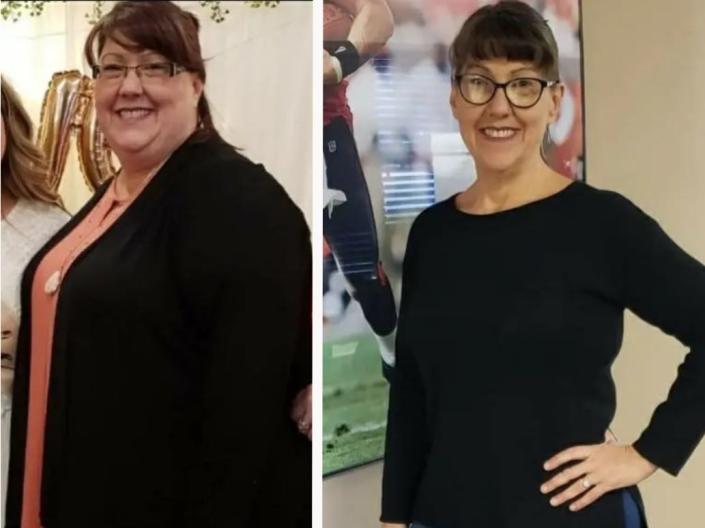 Woman who lost 176 pounds by taking Ozempic competitor Mounjaro is petrified of gaining weight back when she can’t afford to pay $1000 a month